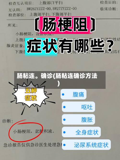 肠粘连。确诊(肠粘连确诊方法)-第3张图片