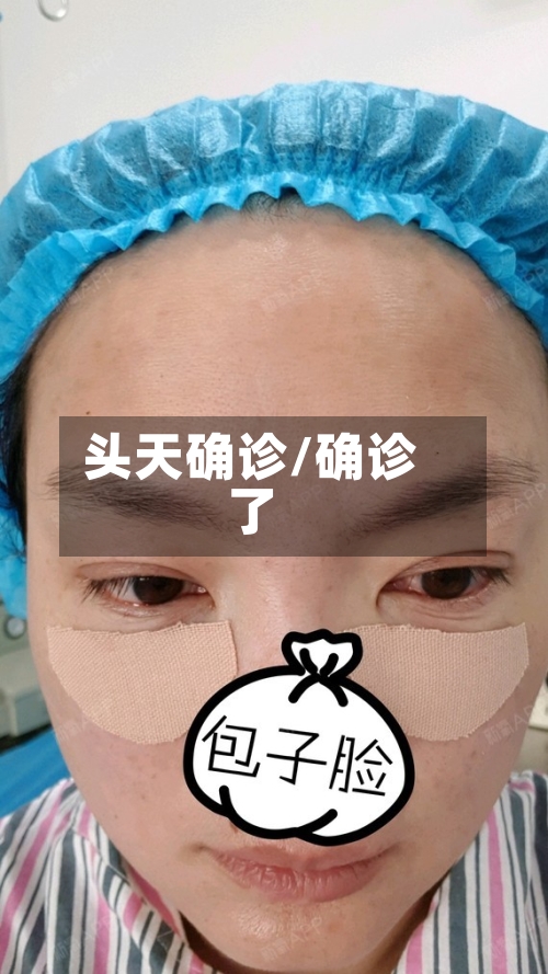 头天确诊/确诊了-第3张图片
