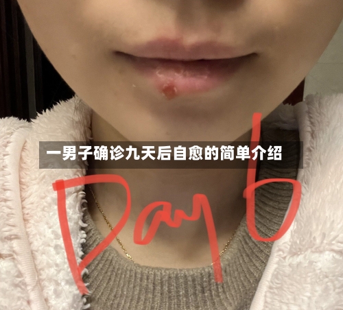 一男子确诊九天后自愈的简单介绍