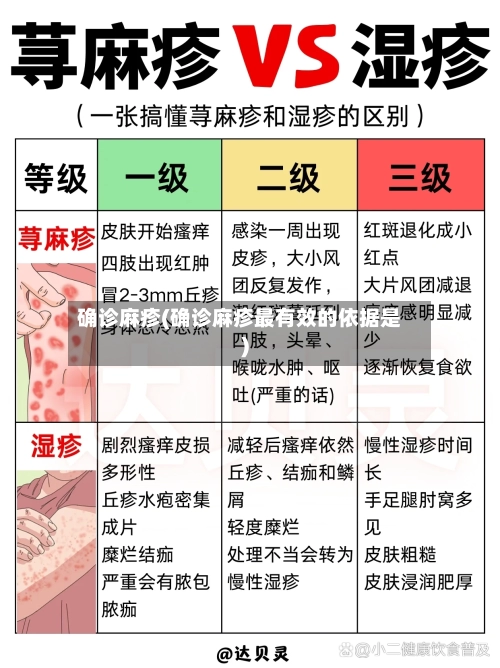 确诊麻疹(确诊麻疹最有效的依据是)