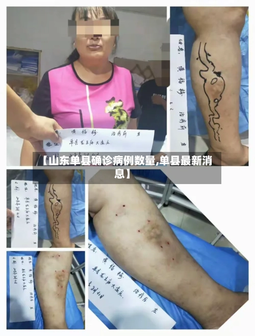 【山东单县确诊病例数量,单县最新消息】-第2张图片