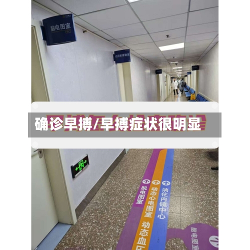 确诊早搏/早搏症状很明显-第2张图片