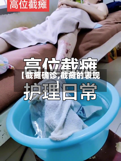 【截瘫确诊,截瘫的表现】-第3张图片