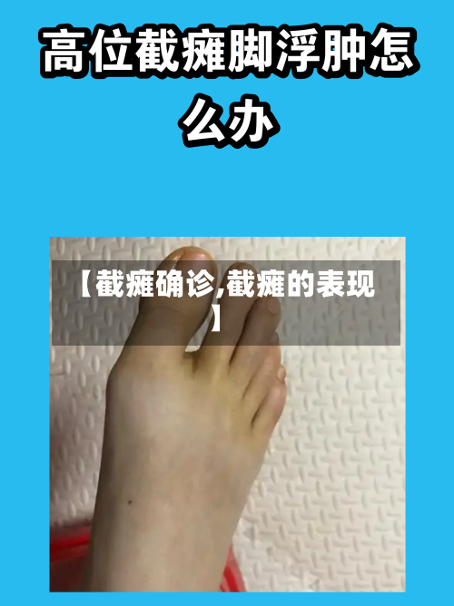 【截瘫确诊,截瘫的表现】