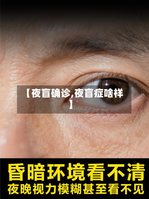 【夜盲确诊,夜盲症啥样】-第2张图片