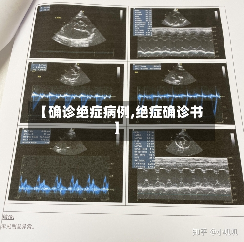 【确诊绝症病例,绝症确诊书】-第2张图片