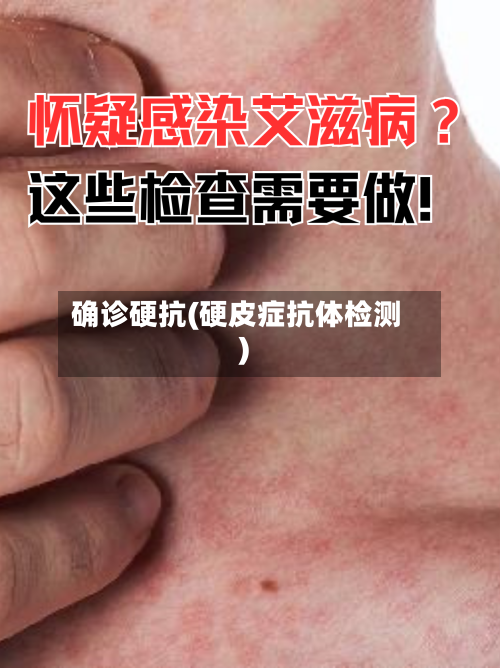 确诊硬抗(硬皮症抗体检测)-第3张图片