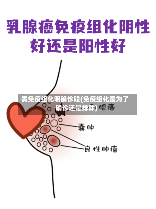 需免疫组化明确诊段(免疫组化是为了确诊还是排除)