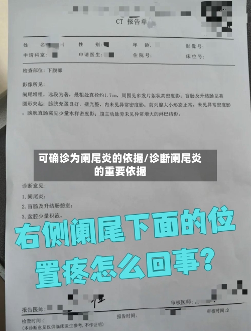 可确诊为阑尾炎的依据/诊断阑尾炎的重要依据-第2张图片