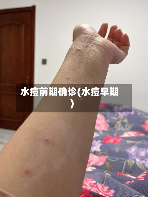 水痘前期确诊(水痘早期)