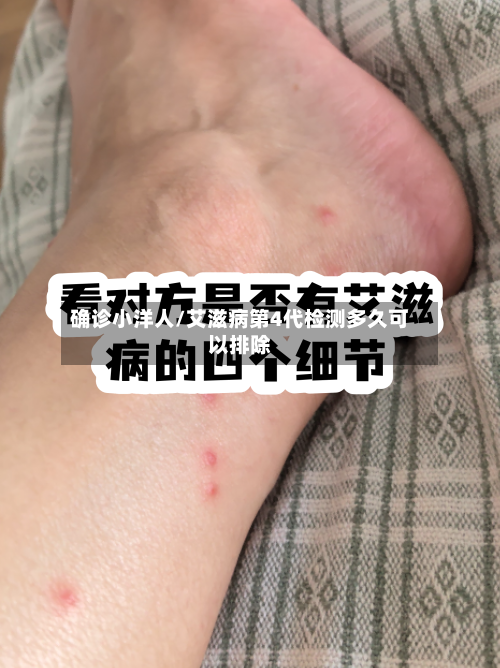 确诊小洋人/艾滋病第4代检测多久可以排除-第1张图片