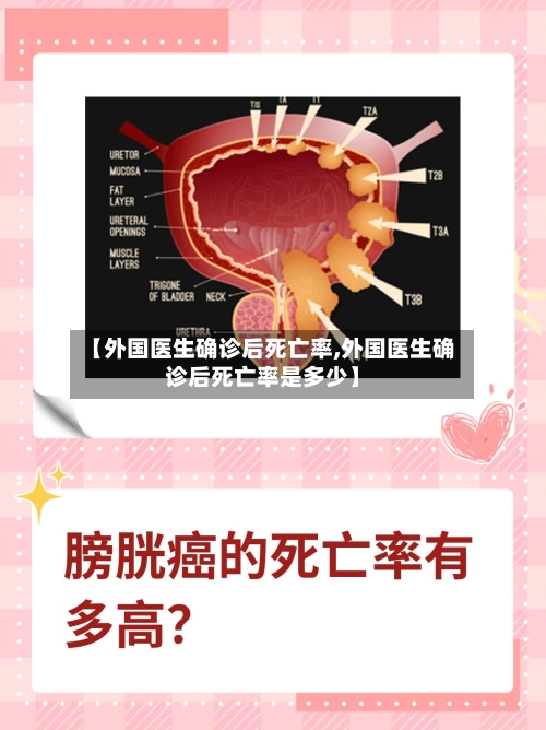 【外国医生确诊后死亡率,外国医生确诊后死亡率是多少】