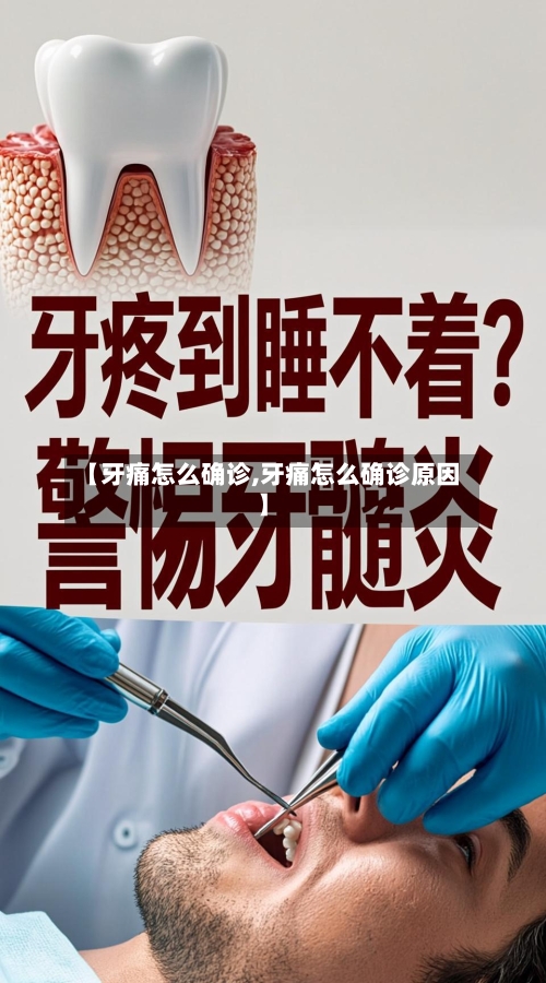 【牙痛怎么确诊,牙痛怎么确诊原因】-第2张图片