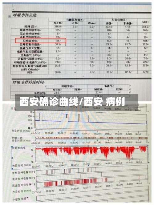 西安确诊曲线/西安 病例