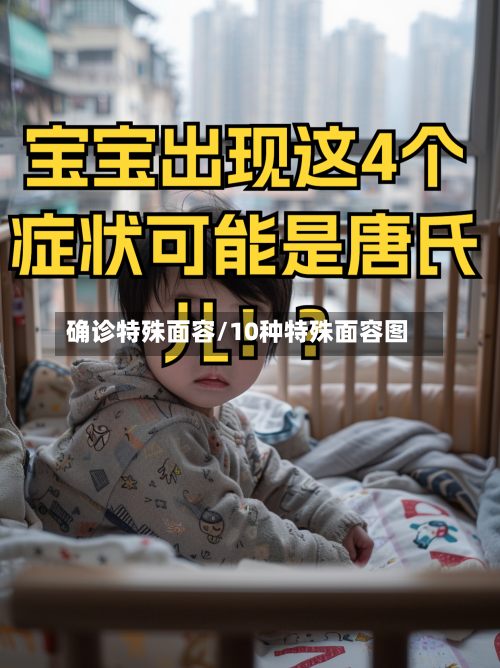 确诊特殊面容/10种特殊面容图