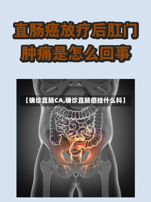 【确诊直肠CA,确诊直肠癌挂什么科】-第2张图片