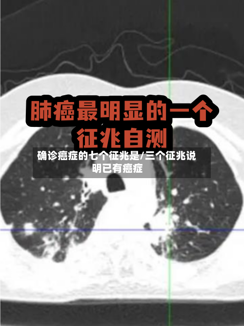 确诊癌症的七个征兆是/三个征兆说明已有癌症-第2张图片
