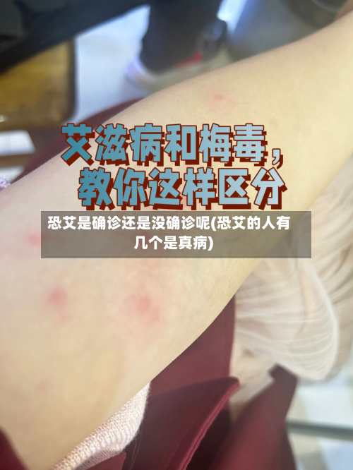恐艾是确诊还是没确诊呢(恐艾的人有几个是真病)-第2张图片