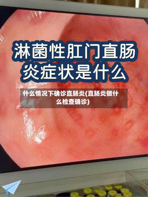 什么情况下确诊直肠炎(直肠炎做什么检查确诊)