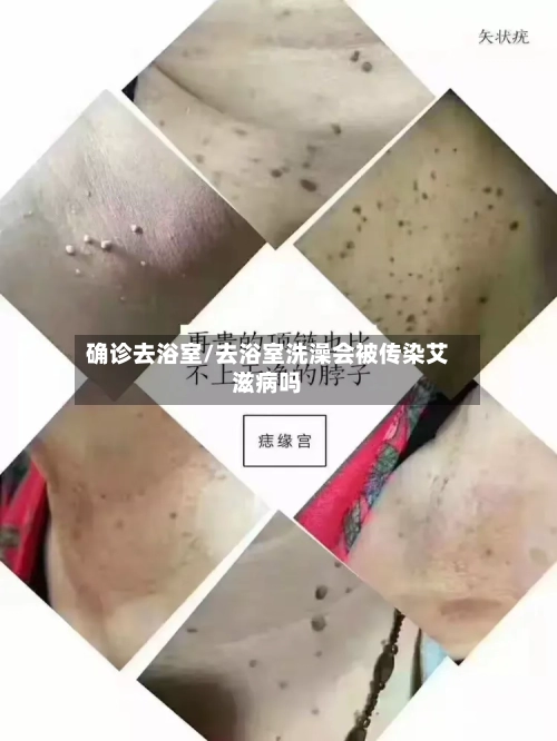 确诊去浴室/去浴室洗澡会被传染艾滋病吗