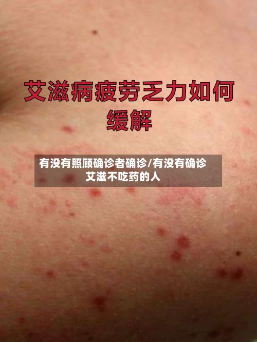 有没有照顾确诊者确诊/有没有确诊艾滋不吃药的人-第2张图片