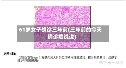 61岁女子确诊三年前(三年前的今天确诊癌说说)
