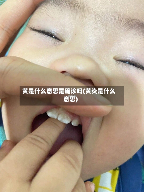 黄是什么意思是确诊吗(黄炎是什么意思)-第2张图片