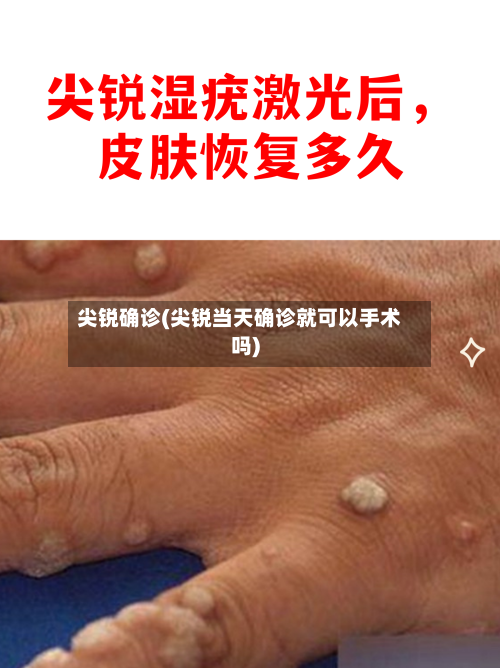 尖锐确诊(尖锐当天确诊就可以手术吗)-第3张图片