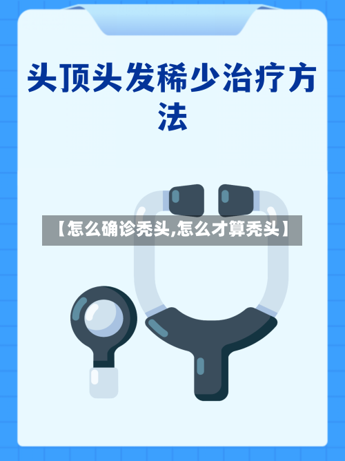 【怎么确诊秃头,怎么才算秃头】