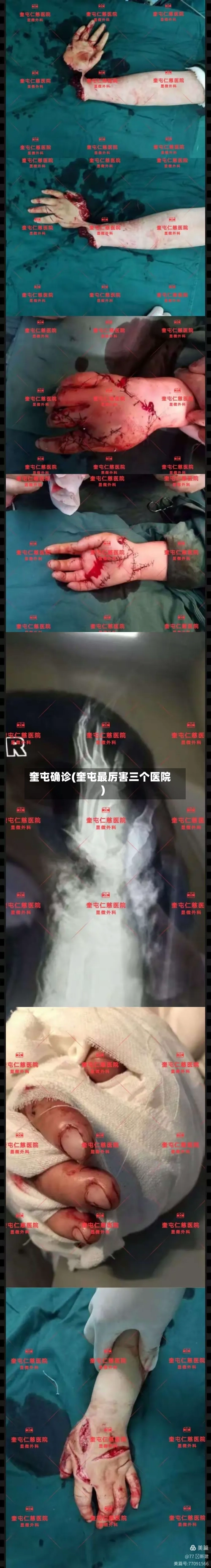 奎屯确诊(奎屯最厉害三个医院)-第3张图片