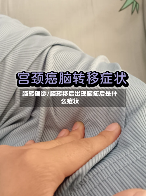脑转确诊/脑转移后出现脑疝后是什么症状-第2张图片