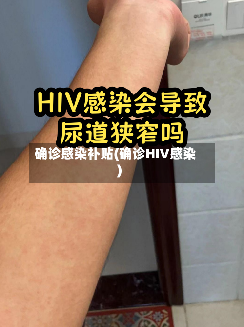 确诊感染补贴(确诊HIV感染)-第3张图片
